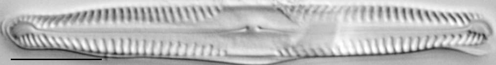 Pinnularia subcapitata var elongata LM7