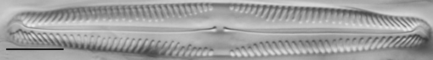 Pinnularia subgibba var. lanceolata LM5