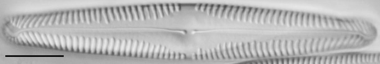 Pinnularia subgibba var. lanceolata LM6