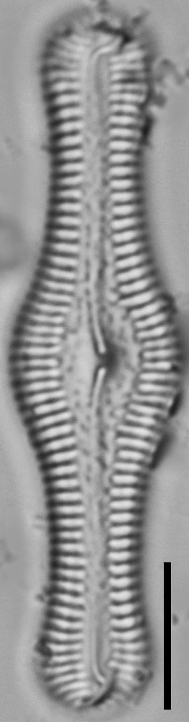Pinnularia turgidula LM3