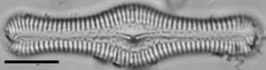 Pinnularia turgidula LM3