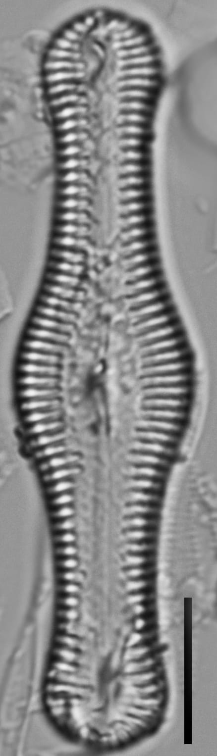 Pinnuaria turgidula LM1