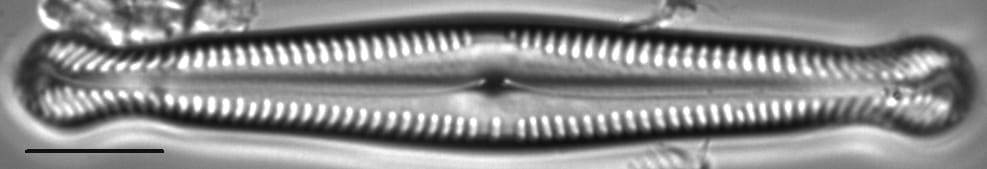 Pinnularia polyonca LM2
