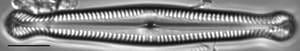 Pinnularia polyonca LM2