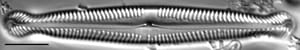 Pinnularia polyonca LM1