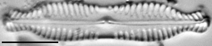 Pinnularia bigibba LM1