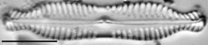 Pinnularia bigibba LM1