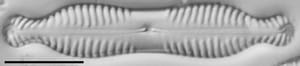 Pinnularia bigibba LM2