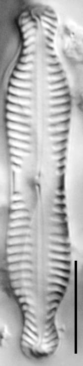 Pinnularia bigibba LM3