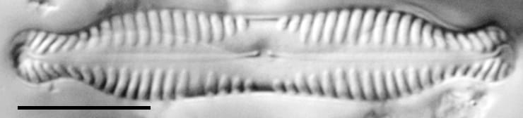 Pinnularia bigibba LM3