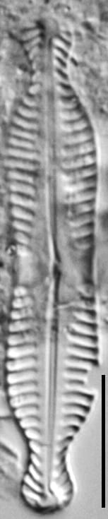 Pinnularia bigibba LM4