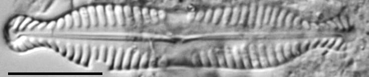 Pinnularia bigibba LM4