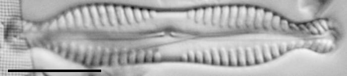 Pinnularia bigibba LM5