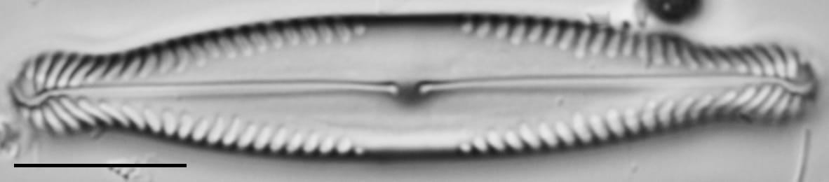 Pinnularia brauniana LM6