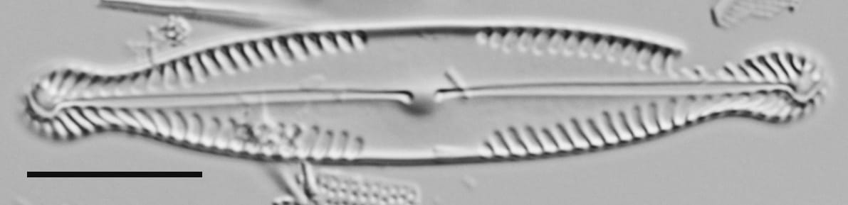 Pinnularia brauniana LM5