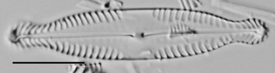 Pinnularia brauniana LM4