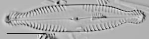 Pinnularia brauniana LM4