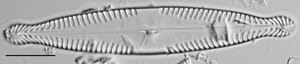 Pinnularia brauniana LM3