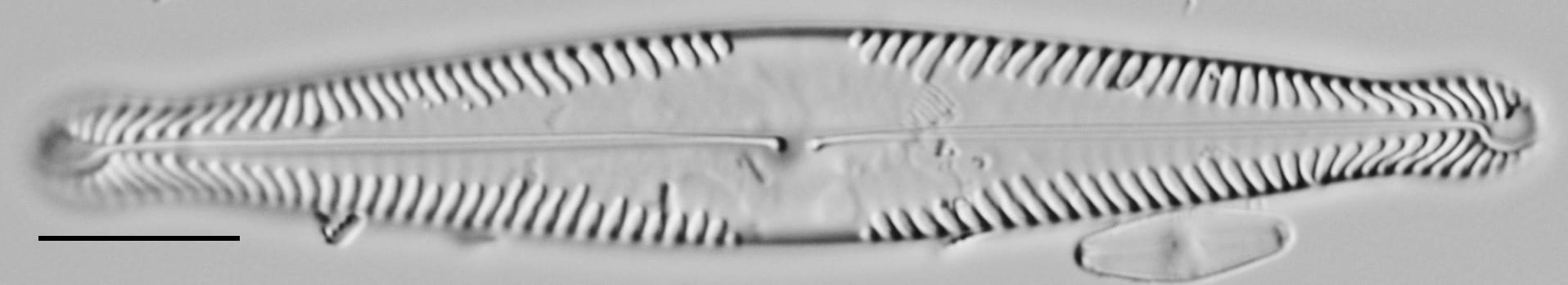 Pinnularia brauniana LM2