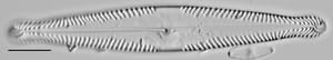 Pinnularia brauniana LM2