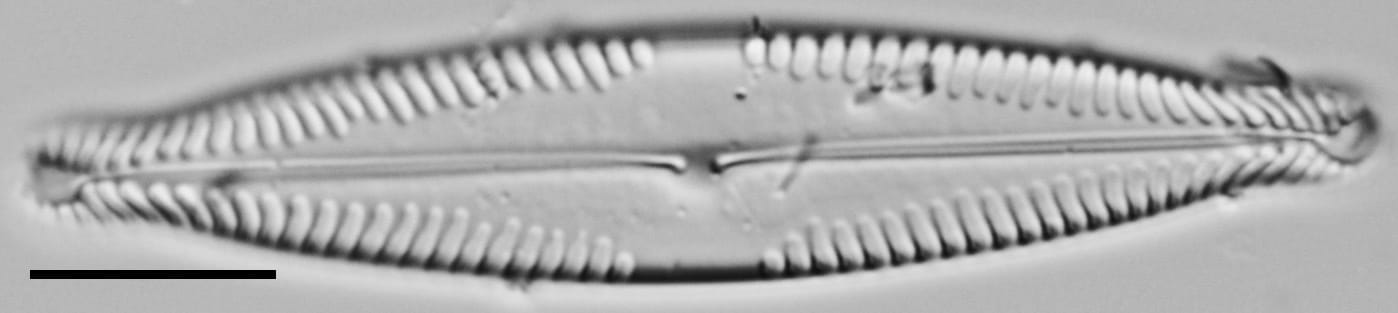 Pinnularia brauniana LM1
