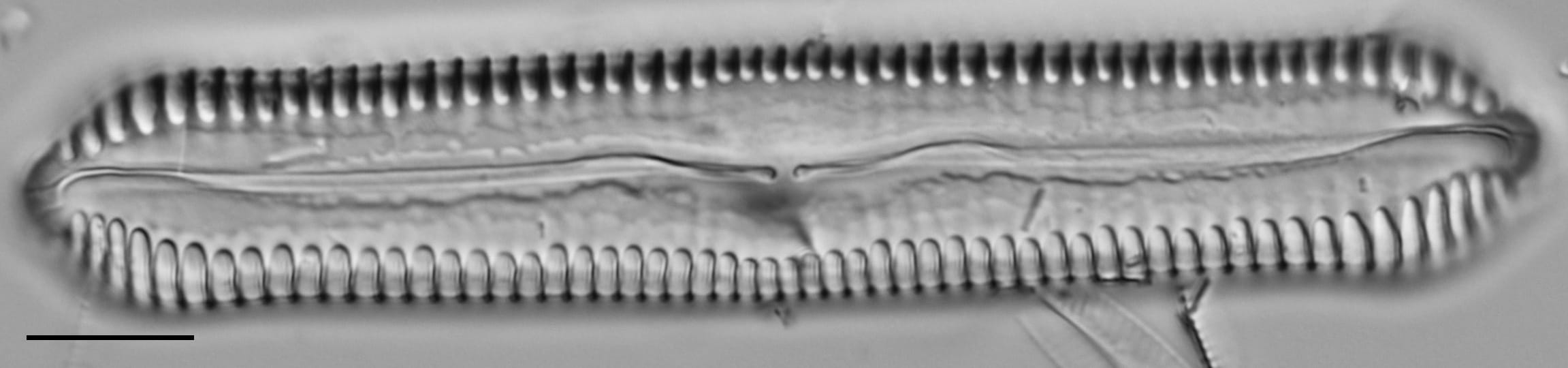 Pinnularia cuneicephala LM7