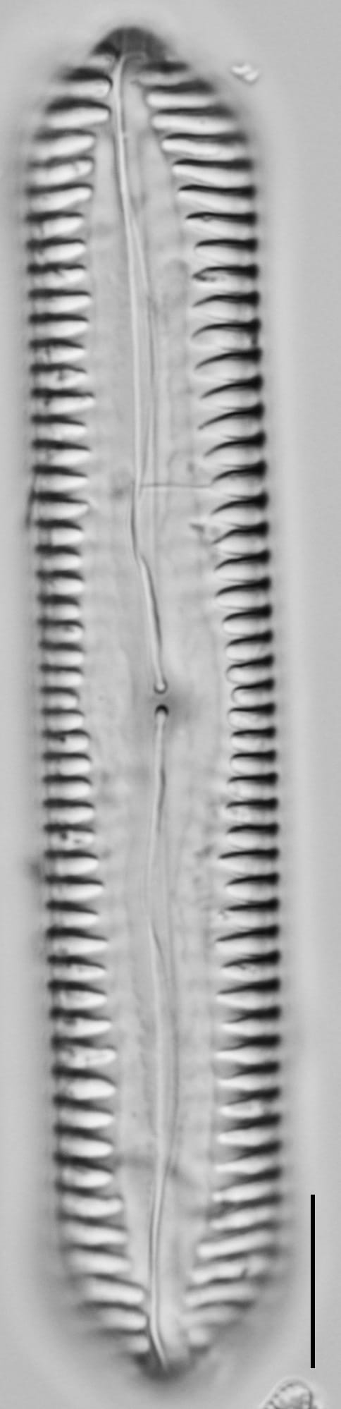 Pinnularia cuneicephala LM2