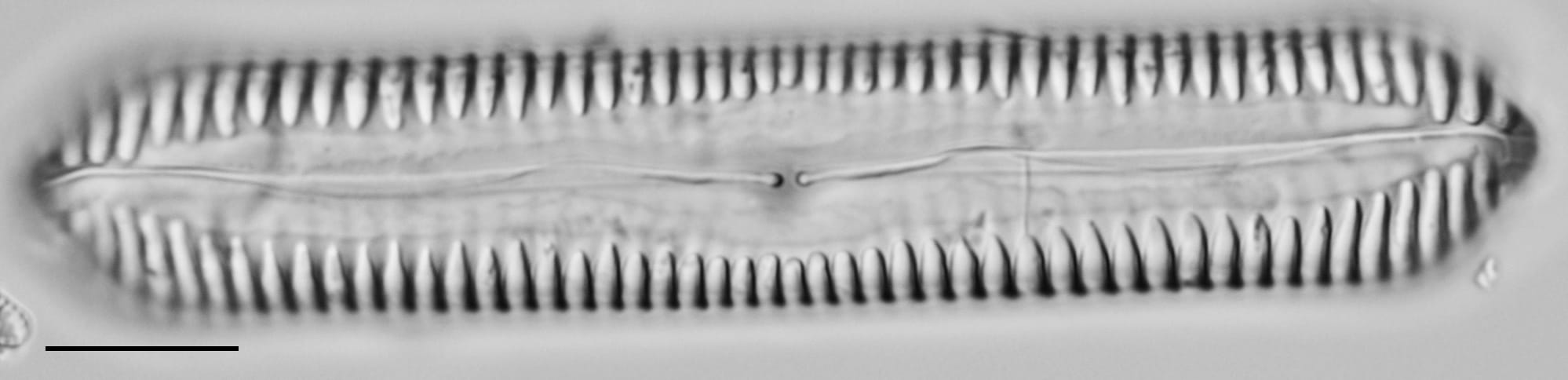 Pinnularia cuneicephala LM2