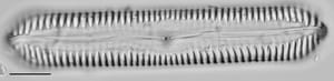 Pinnularia cuneicephala LM2