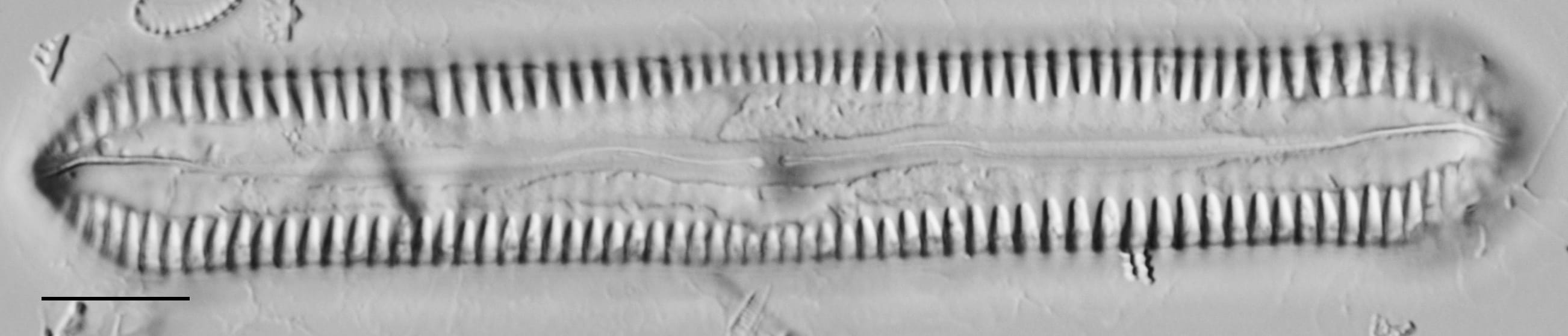 Pinnularia cuneicephala LM1