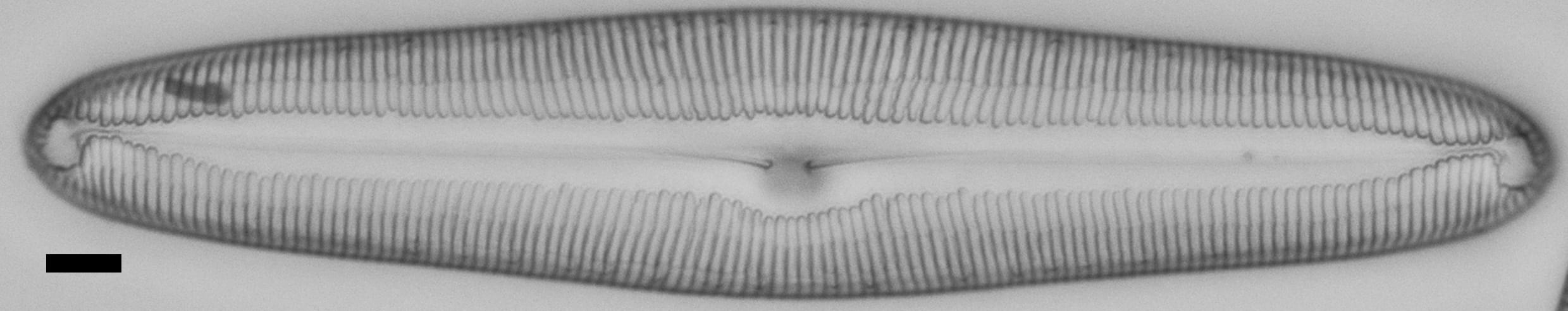 Pinnularia dariana ANSP Boy E 5 19 2