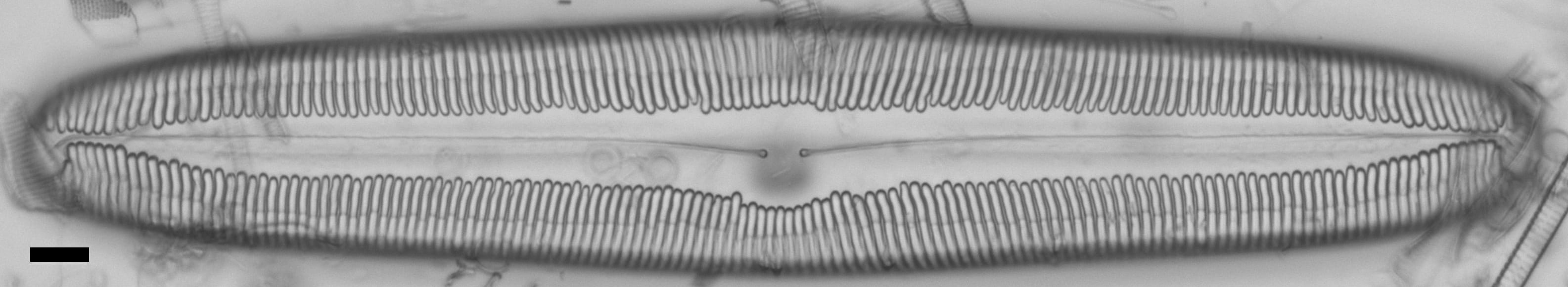 Pinnularia dariana ANSP NJSS0692 1