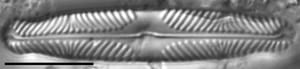Pinnularia divergentissima subrostrata LM1