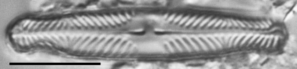 Pinnularia divergentissima subrostrata LM2