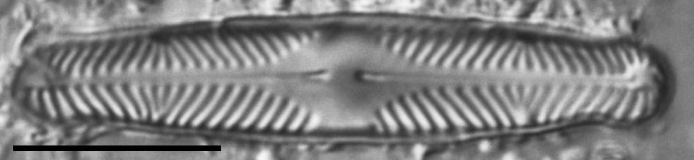 Pinnularia divergentissima subrostrata LM3