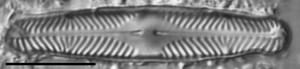 Pinnularia divergentissima subrostrata LM3
