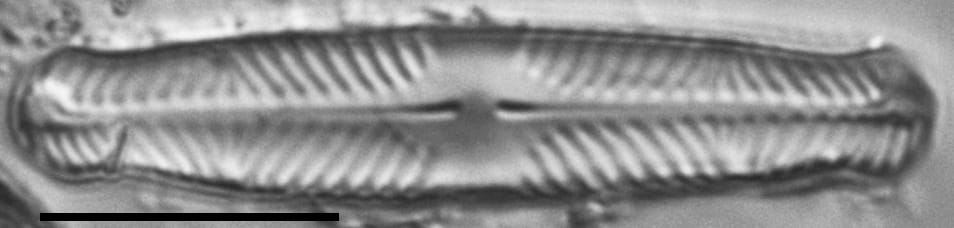 Pinnularia divergentissima subrostrata LM4