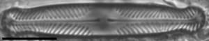 Pinnularia divergentissima subrostrata LM6