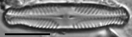 Pinnularia divergentissima subrostrata LM7