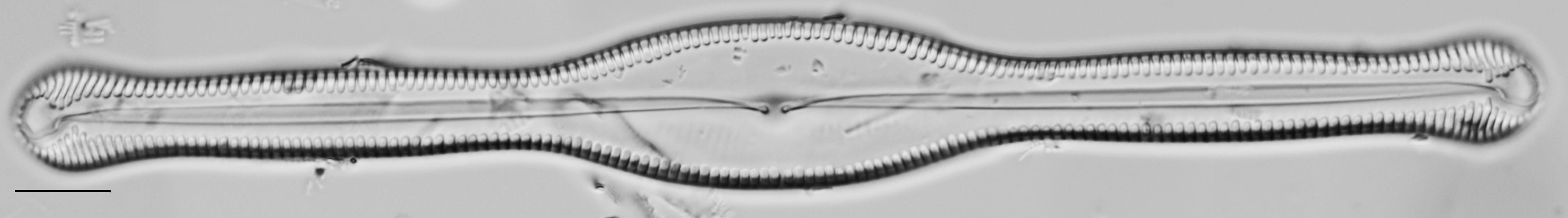 Pinnularia formica LM6