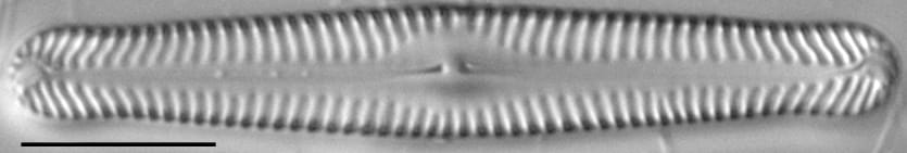 Pinnularia gibbiformis ANSP 00404 01