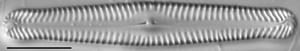 Pinnularia gibbiformis ANSP 00404 01