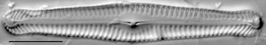 Pinnularia gibbiformis ANSP 00404 02