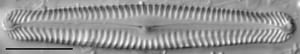 Pinnularia gibbiformis ANSP 00404 04