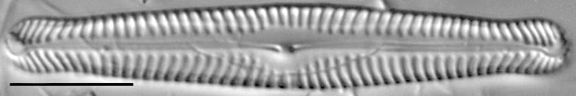 Pinnularia gibbiformis ANSP 00404 05