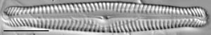 Pinnularia gibbiformis ANSP 00404 05