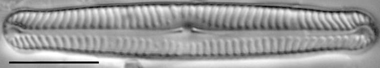Pinnularia gibbiformis ANSP 00404 06
