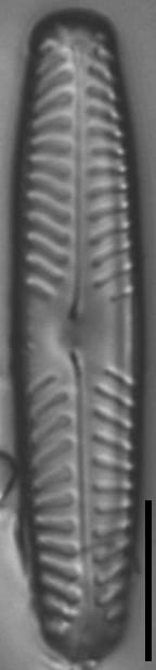 Pinnularia intermedia LM2