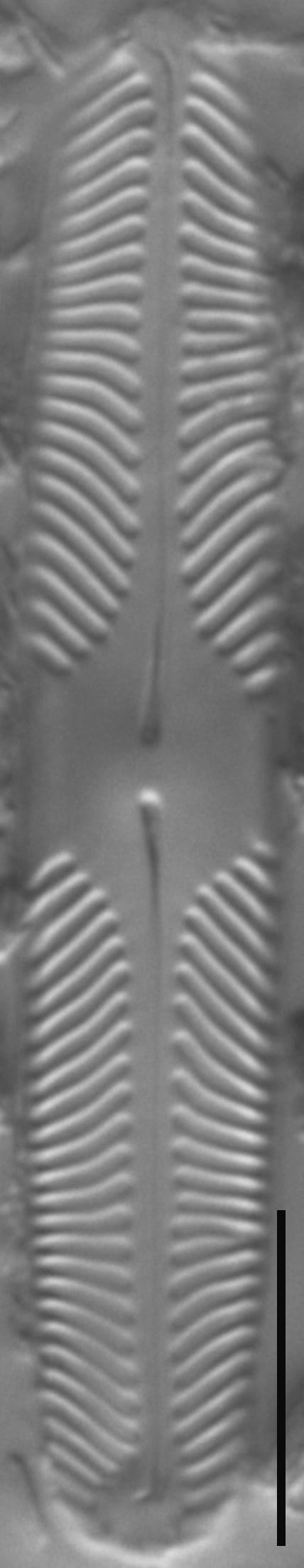 Pinnularia lacunicola LM1