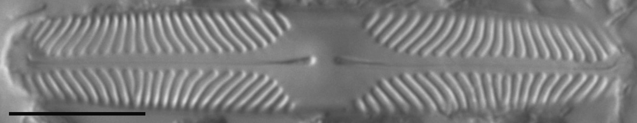 Pinnularia lacunicola LM1